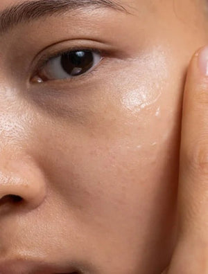 Hydratatie boost gel met hyaluronzuur – 30 ml - CALMTACT