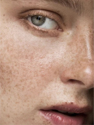 Pigment perfecting serum - 30 ml - CALMTACT